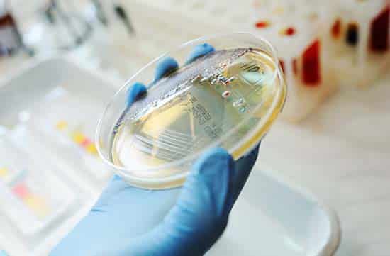Image depicting Bacteriology at PDS Inc